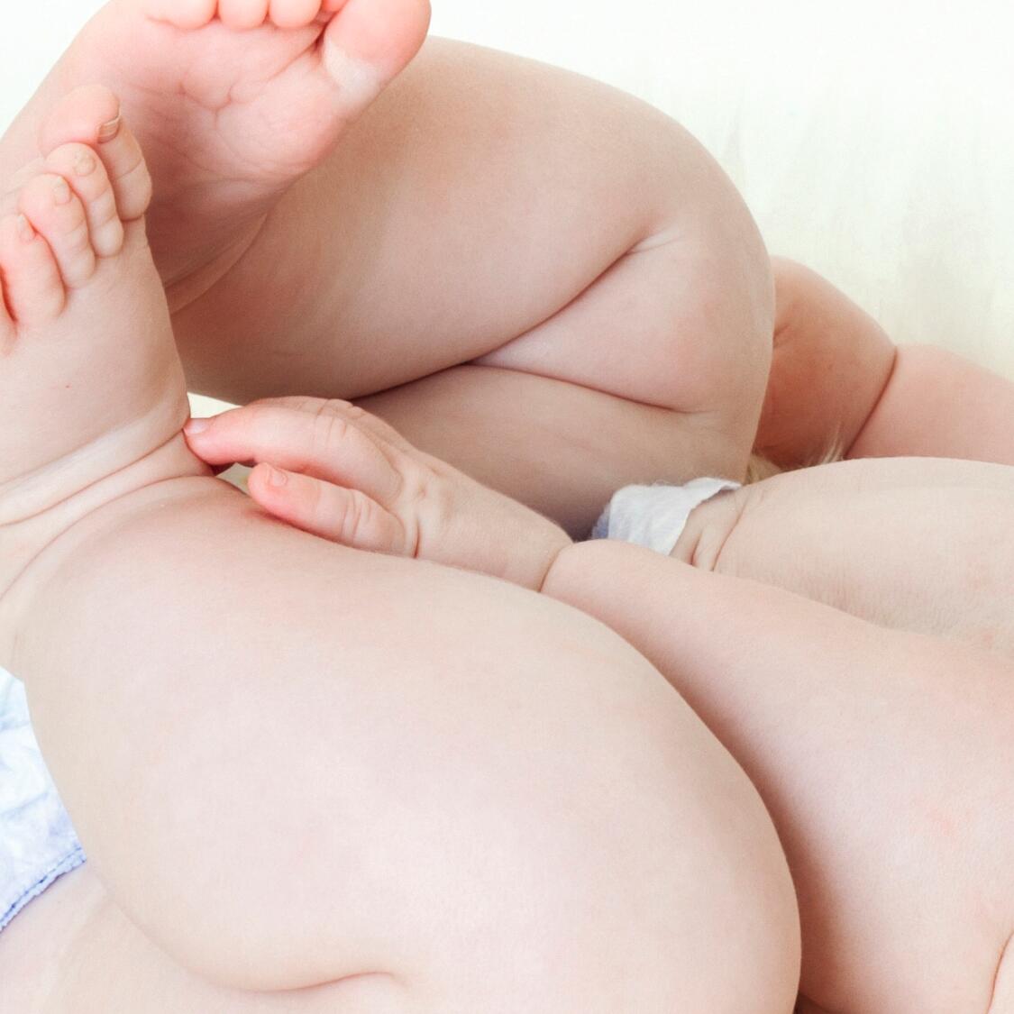 intertrigo pliegue piernas bebé